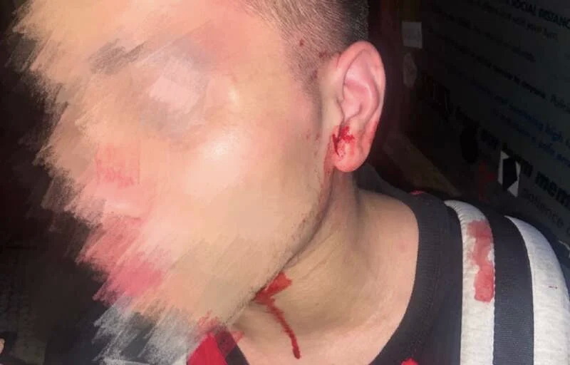 威斯康星州Madison读博的中国男生被袭击